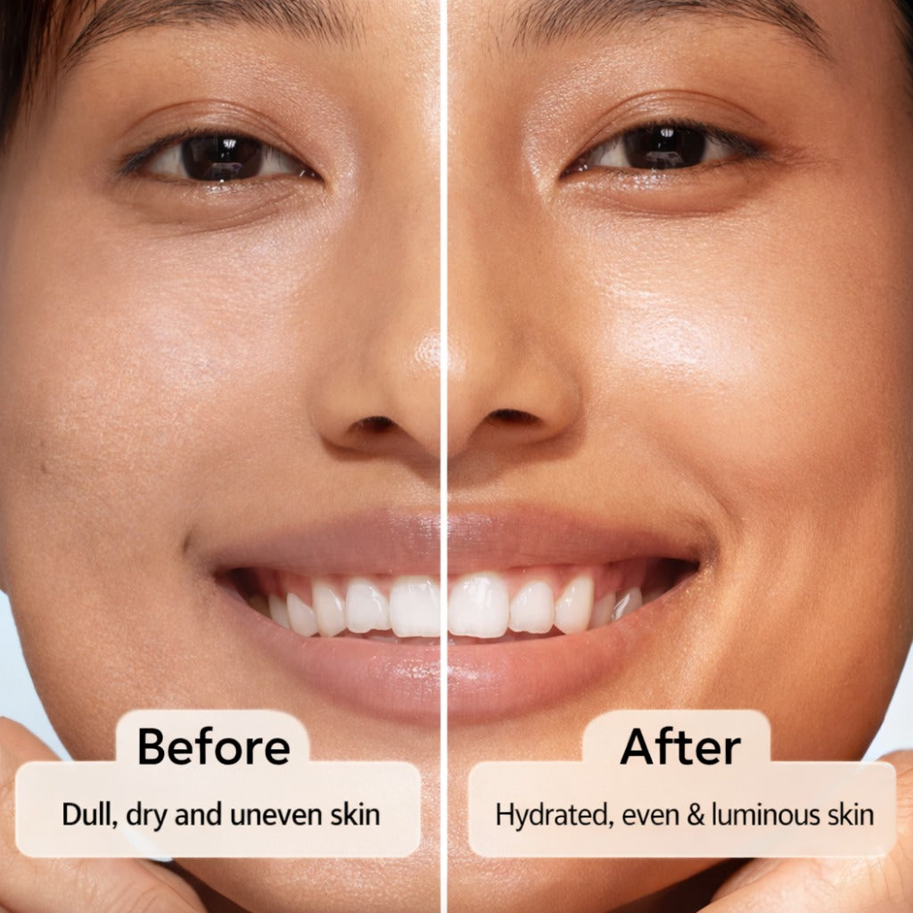 Gel Moisturizer - 100ml