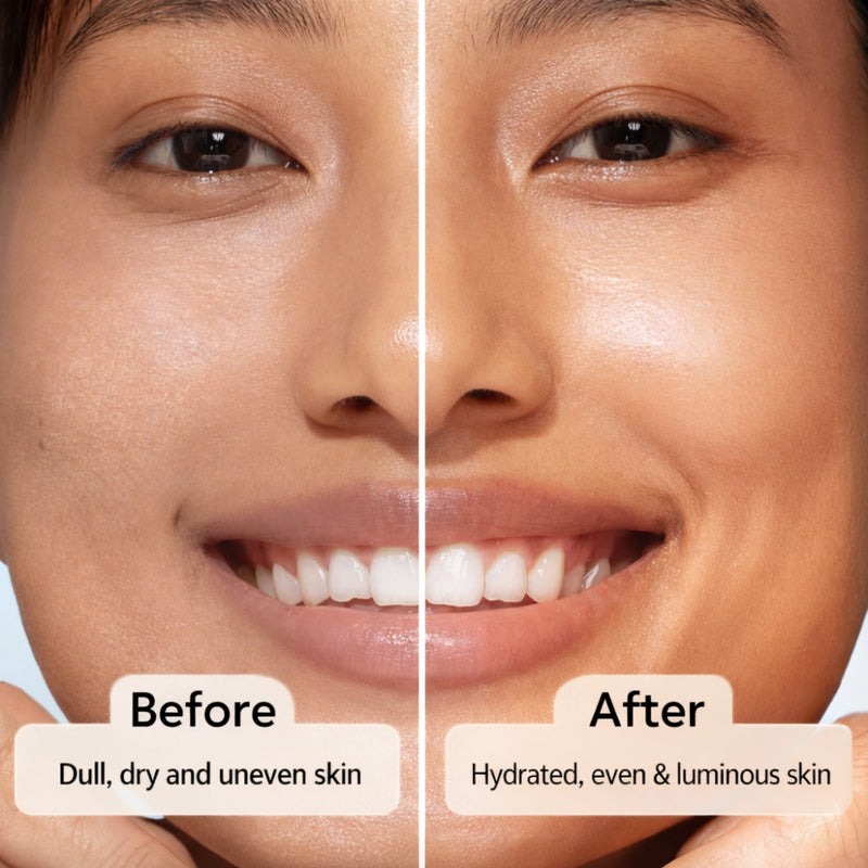 Gel Moisturizer - 100ml